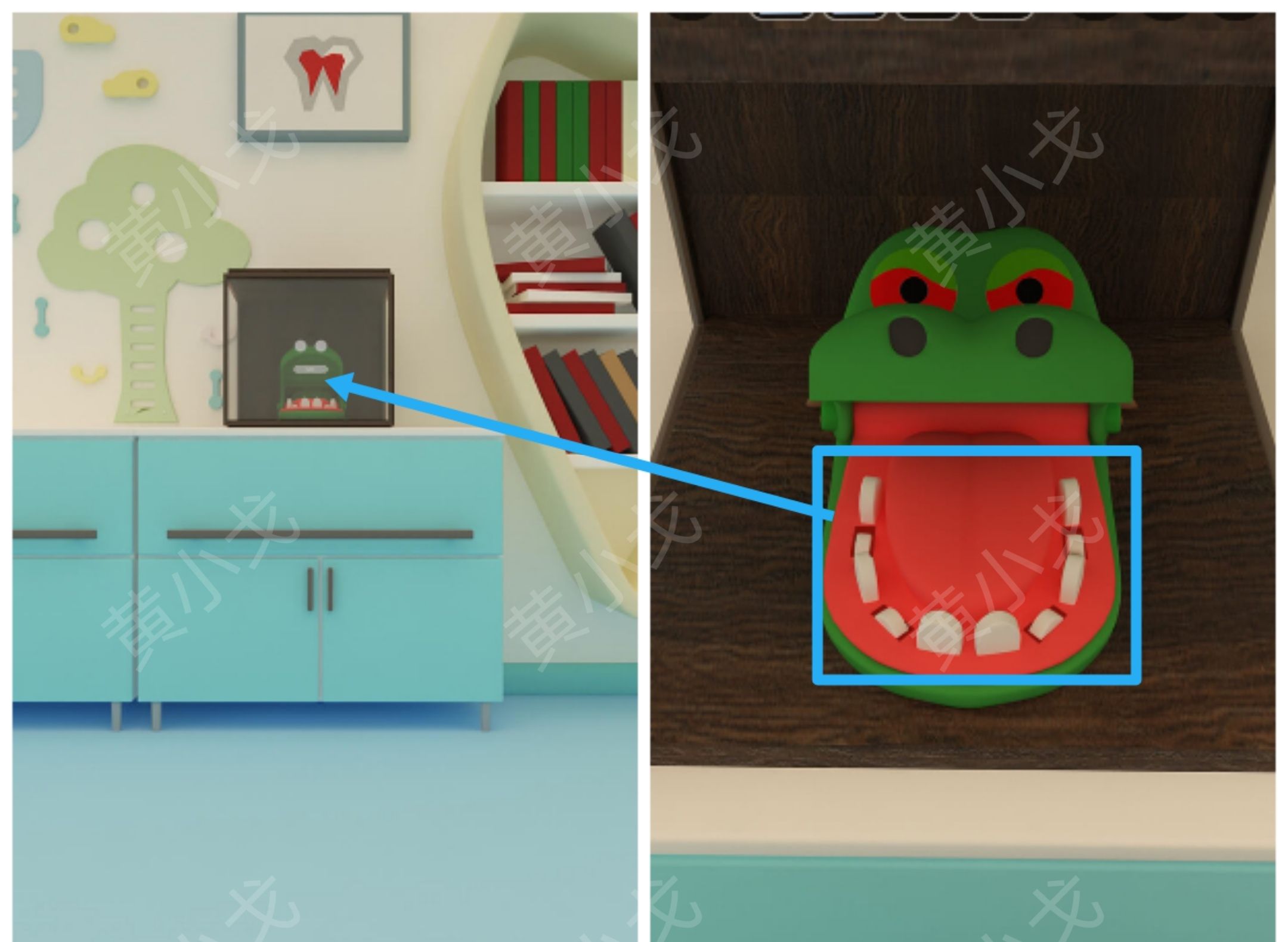 Escape Room：Dental（密室逃脱：牙科诊所）攻略（一）