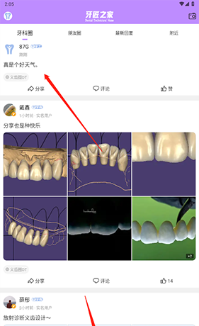 牙匠之家app动态删除方法