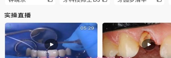 牙匠之家app动态删除方法